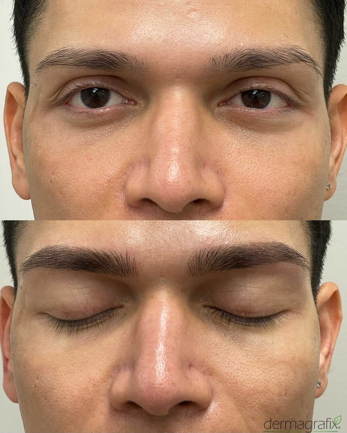 Male client before and after Bi-Fusion brows, with matched face scale in both panels