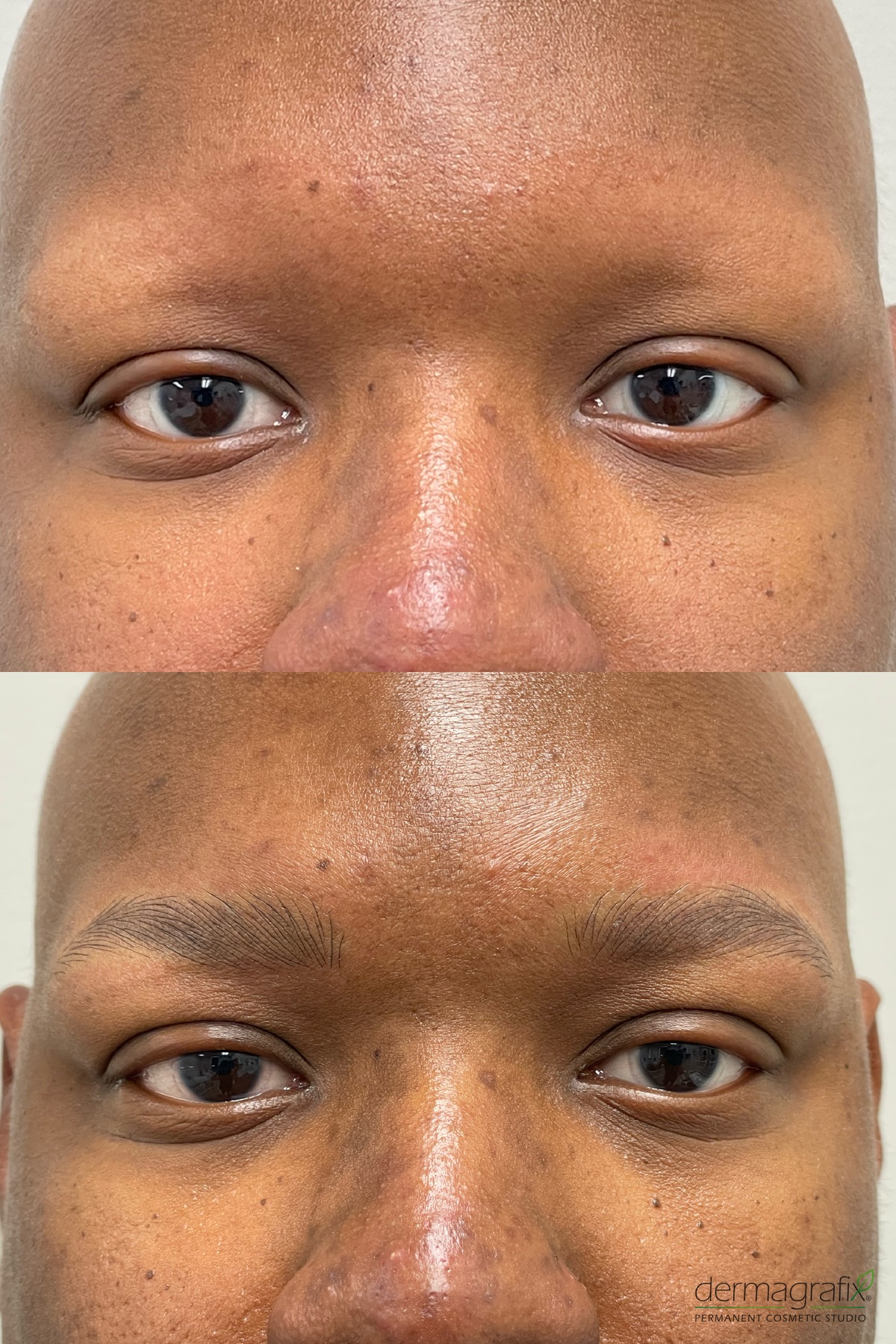 Male client with alopecia before and after nanostroke permanent makeup brows, with matched face scale in both panels