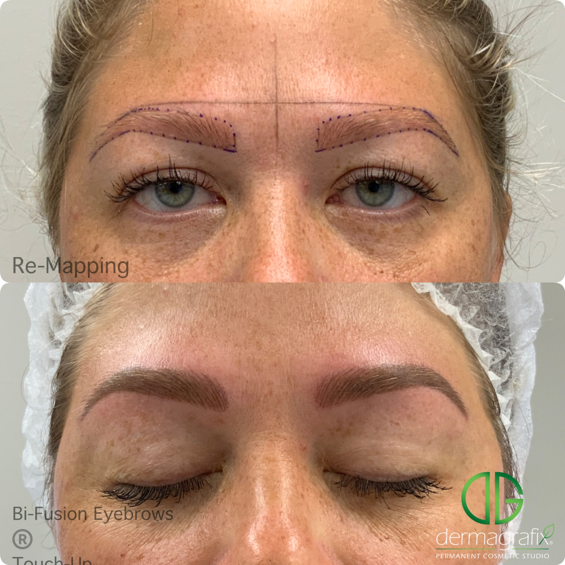 Brow re-mapping followed by healed machine nano-stroke Bi-Fusion brows