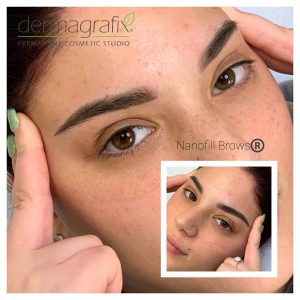 nanofill powder brows healed result 